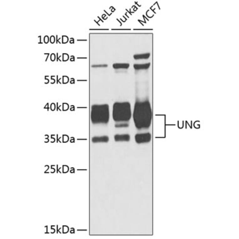 Western Blot - Anti-UNG Antibody (A11430) - Antibodies.com