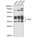 Western Blot - Anti-UNG Antibody (A11430) - Antibodies.com