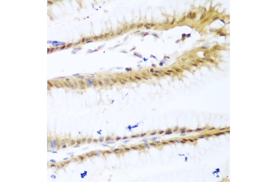 Immunohistochemistry - Anti-UNG Antibody (A11430) - Antibodies.com