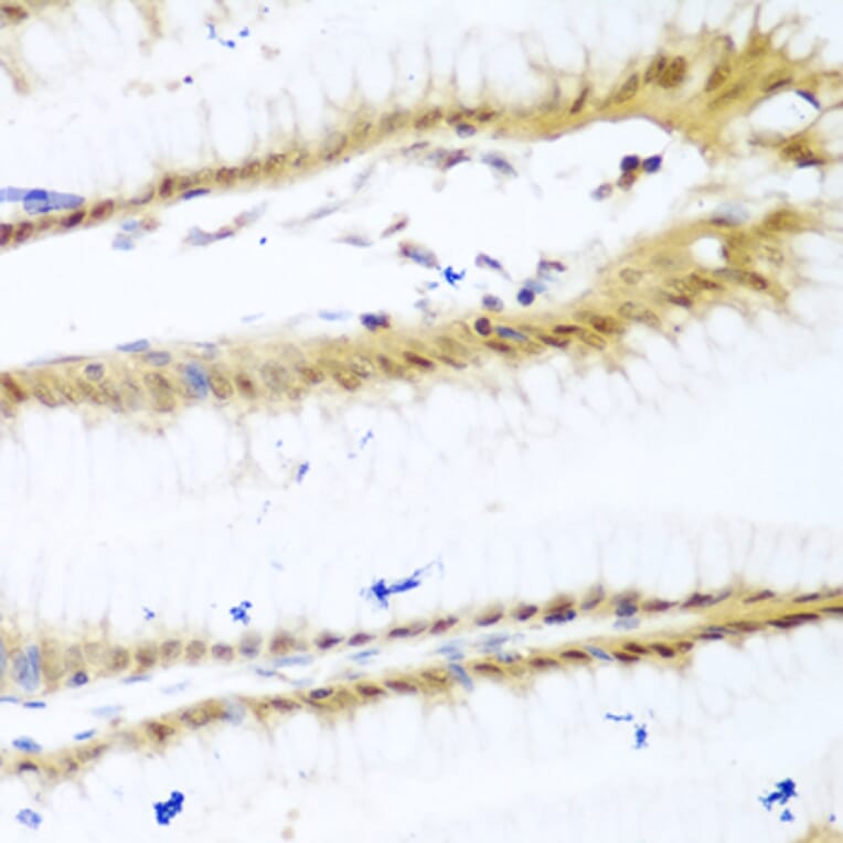 Immunohistochemistry - Anti-UNG Antibody (A11430) - Antibodies.com