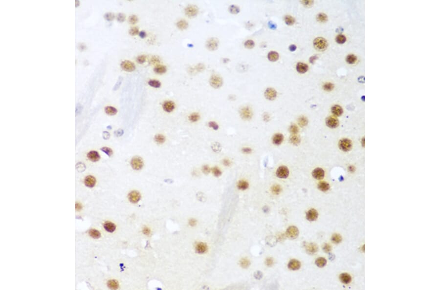 Immunohistochemistry - Anti-UNG Antibody (A11430) - Antibodies.com