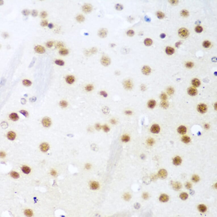 Immunohistochemistry - Anti-UNG Antibody (A11430) - Antibodies.com