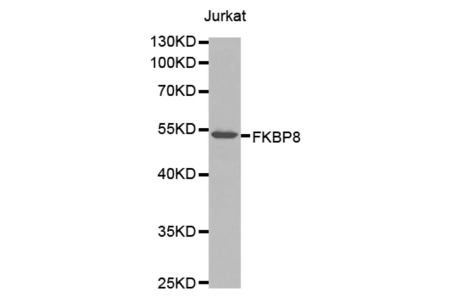 Western Blot - Anti-FKBP8 Antibody (A1268) - Antibodies.com