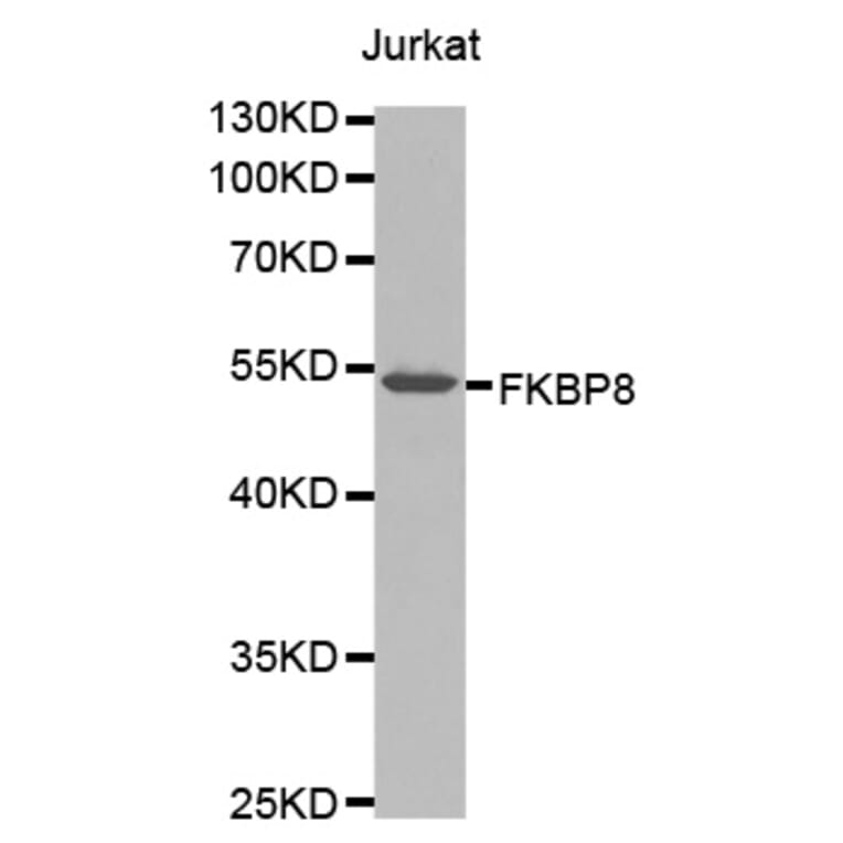 Western Blot - Anti-FKBP8 Antibody (A1268) - Antibodies.com