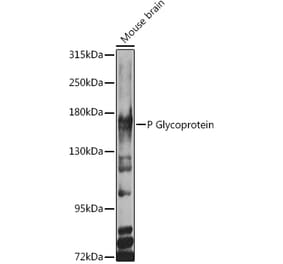 Western Blot - Anti-P Glycoprotein Antibody (A11432) - Antibodies.com