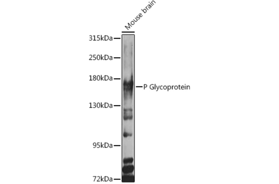 Western Blot - Anti-P Glycoprotein Antibody (A11432) - Antibodies.com
