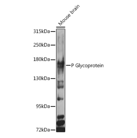 Western Blot - Anti-P Glycoprotein Antibody (A11432) - Antibodies.com