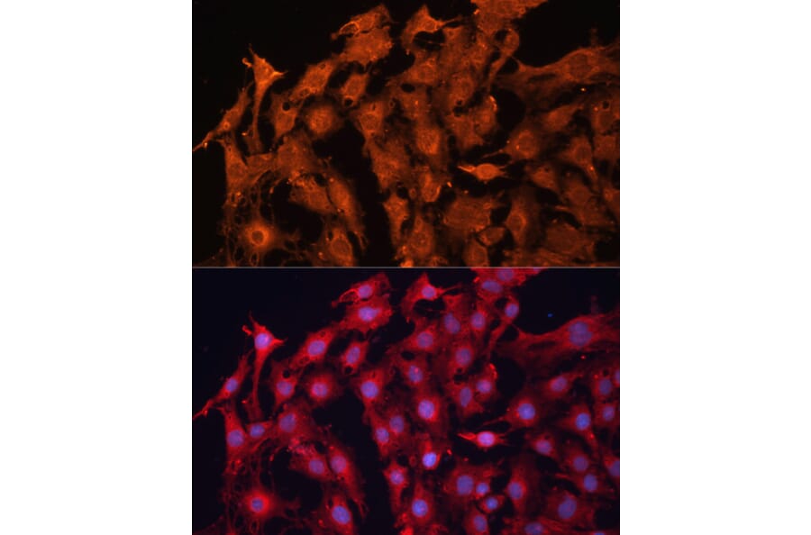 Immunofluorescence - Anti-P Glycoprotein Antibody (A11432) - Antibodies.com