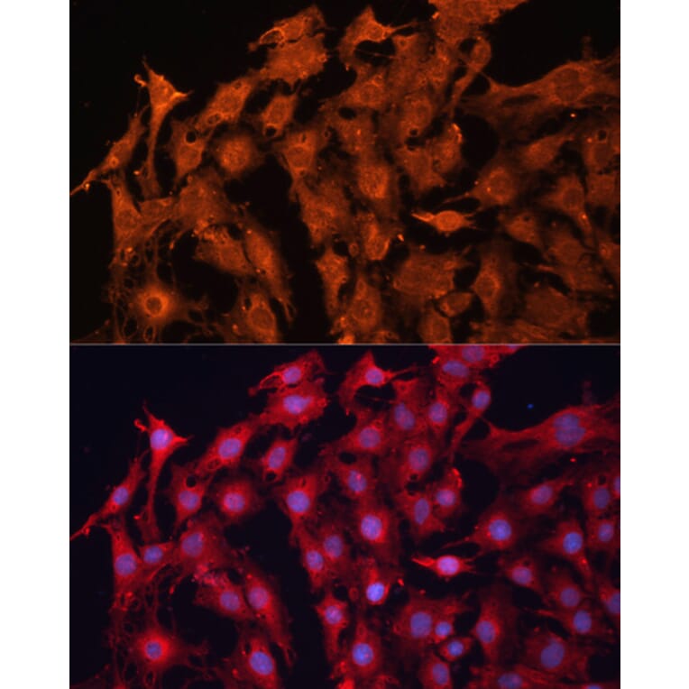 Immunofluorescence - Anti-P Glycoprotein Antibody (A11432) - Antibodies.com