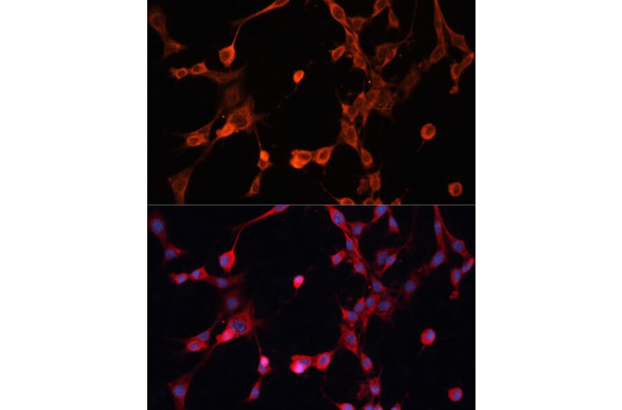 Immunofluorescence - Anti-P Glycoprotein Antibody (A11432) - Antibodies.com