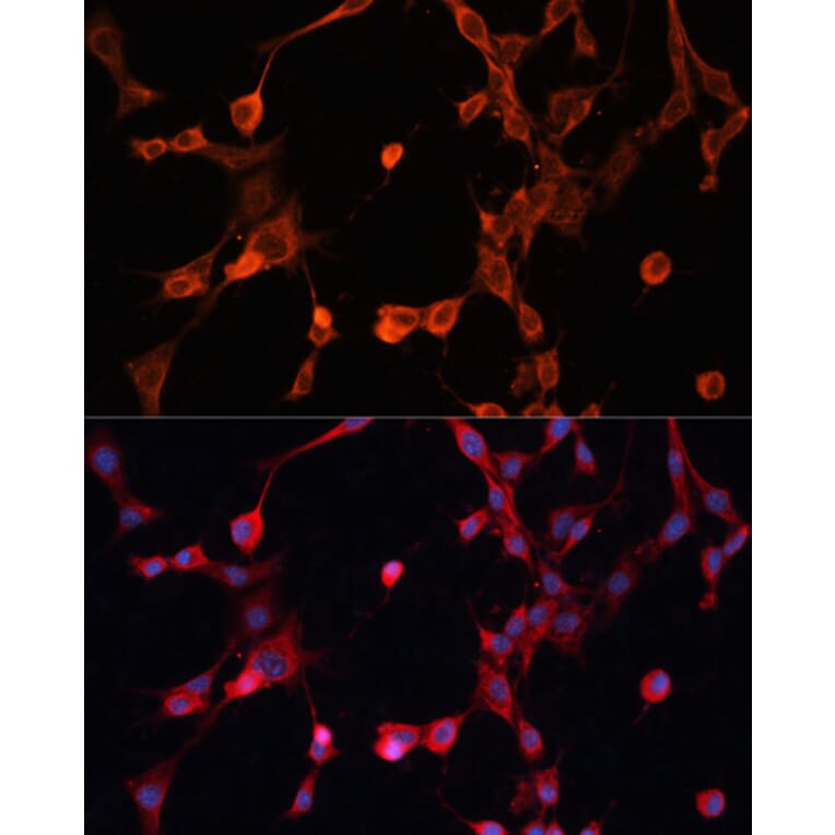 Immunofluorescence - Anti-P Glycoprotein Antibody (A11432) - Antibodies.com