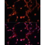 Immunofluorescence - Anti-P Glycoprotein Antibody (A11432) - Antibodies.com