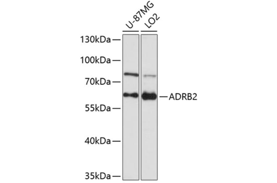 Western Blot - Anti-ADRB2 Antibody (A1295) - Antibodies.com