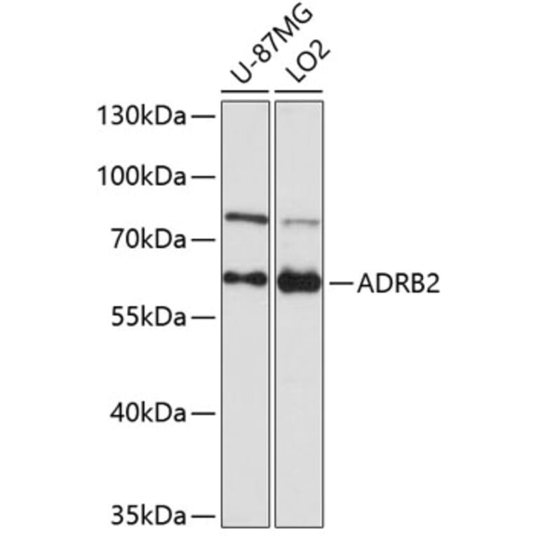 Western Blot - Anti-ADRB2 Antibody (A1295) - Antibodies.com