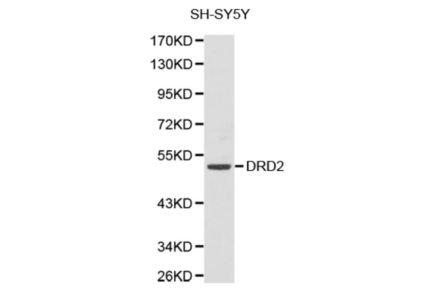 Western Blot - Anti-DRD2 Antibody (A1296) - Antibodies.com