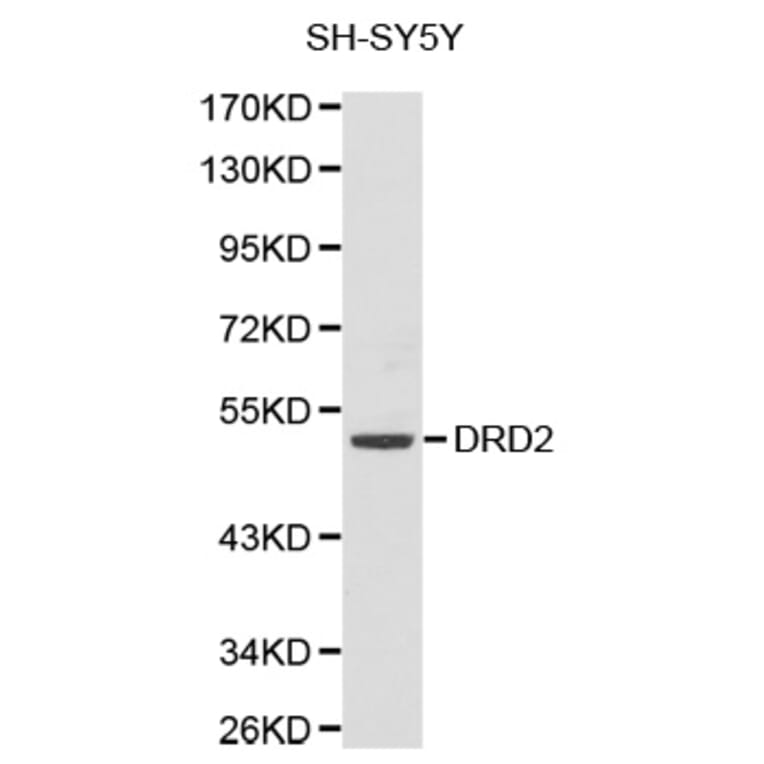 Western Blot - Anti-DRD2 Antibody (A1296) - Antibodies.com