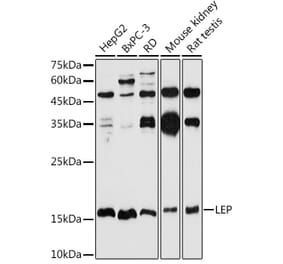 Western Blot - Anti-Leptin Antibody (A11435) - Antibodies.com