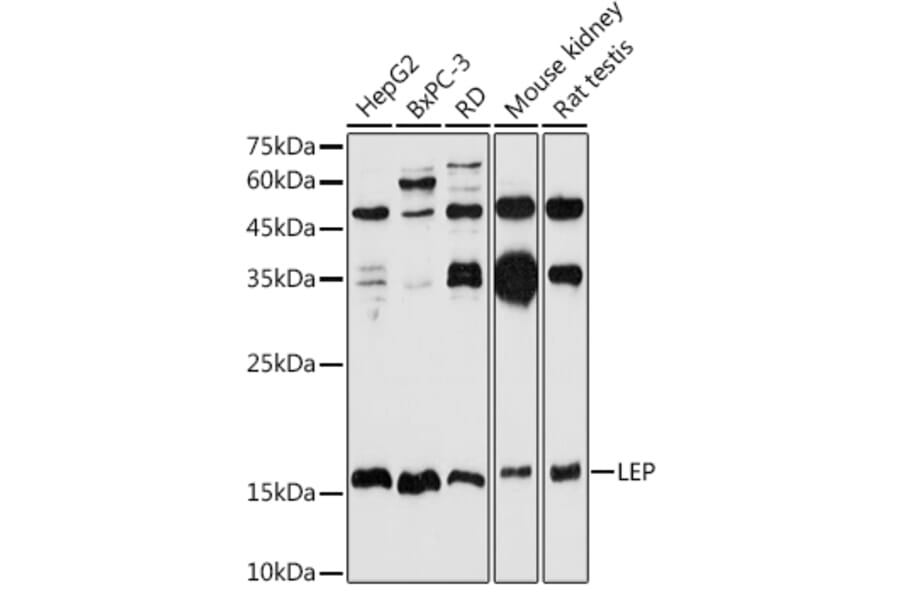 Western Blot - Anti-Leptin Antibody (A11435) - Antibodies.com