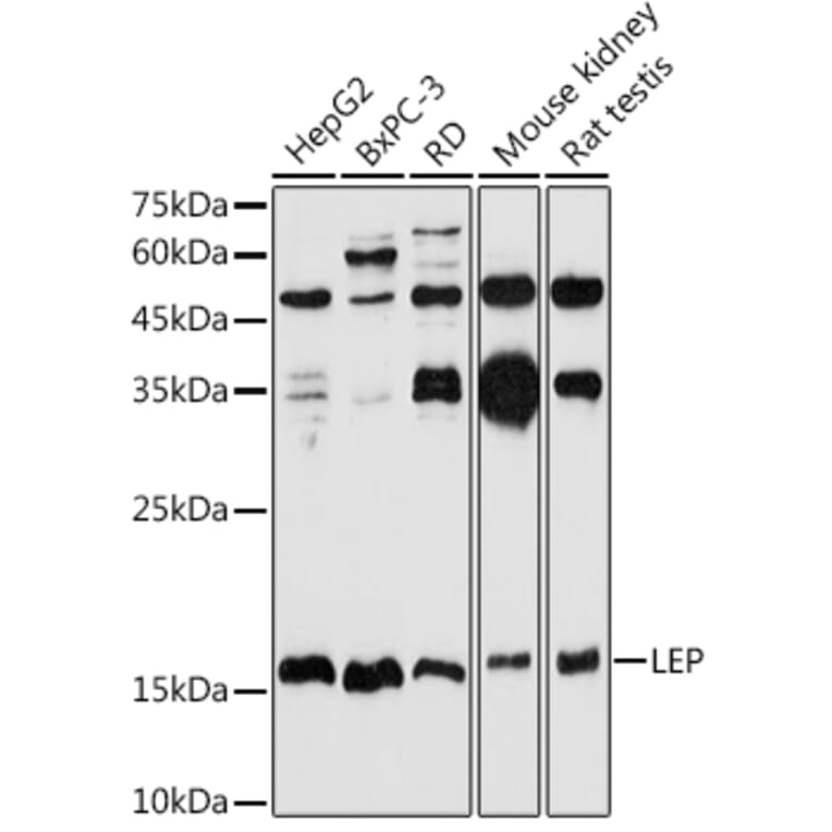 Western Blot - Anti-Leptin Antibody (A11435) - Antibodies.com