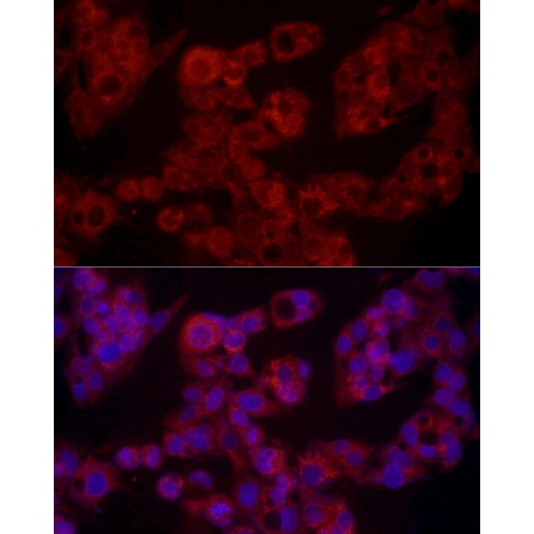 Immunofluorescence - Anti-Leptin Antibody (A11435) - Antibodies.com