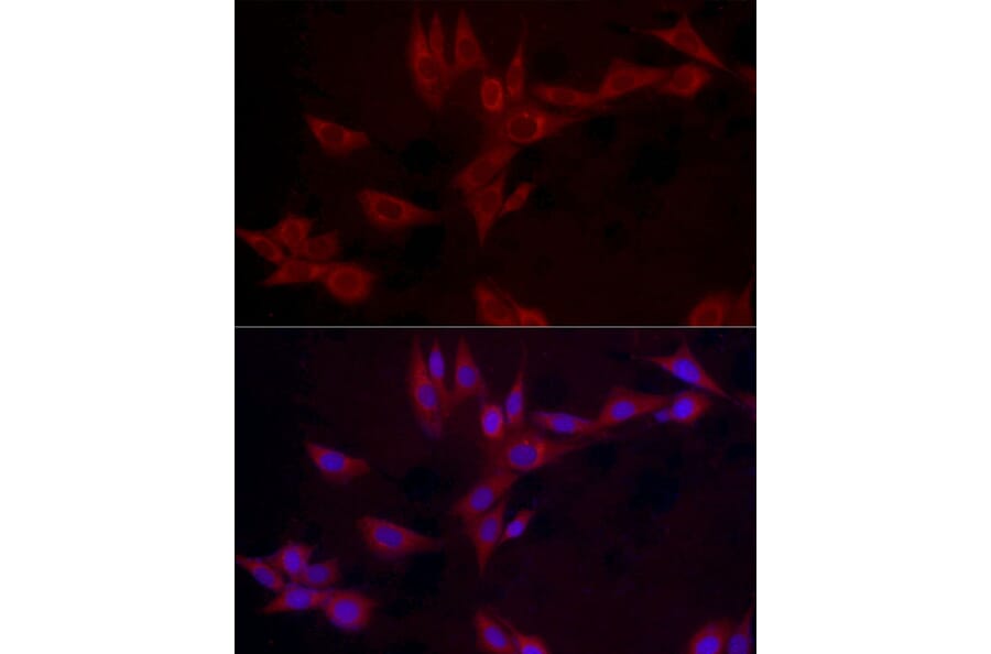 Immunofluorescence - Anti-Leptin Antibody (A11435) - Antibodies.com