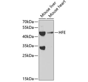 Western Blot - Anti-HFE Antibody (A11436) - Antibodies.com