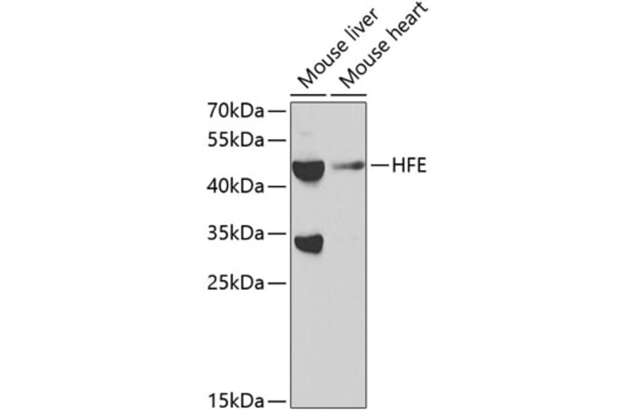Western Blot - Anti-HFE Antibody (A11436) - Antibodies.com