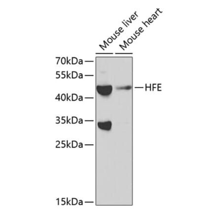 Western Blot - Anti-HFE Antibody (A11436) - Antibodies.com