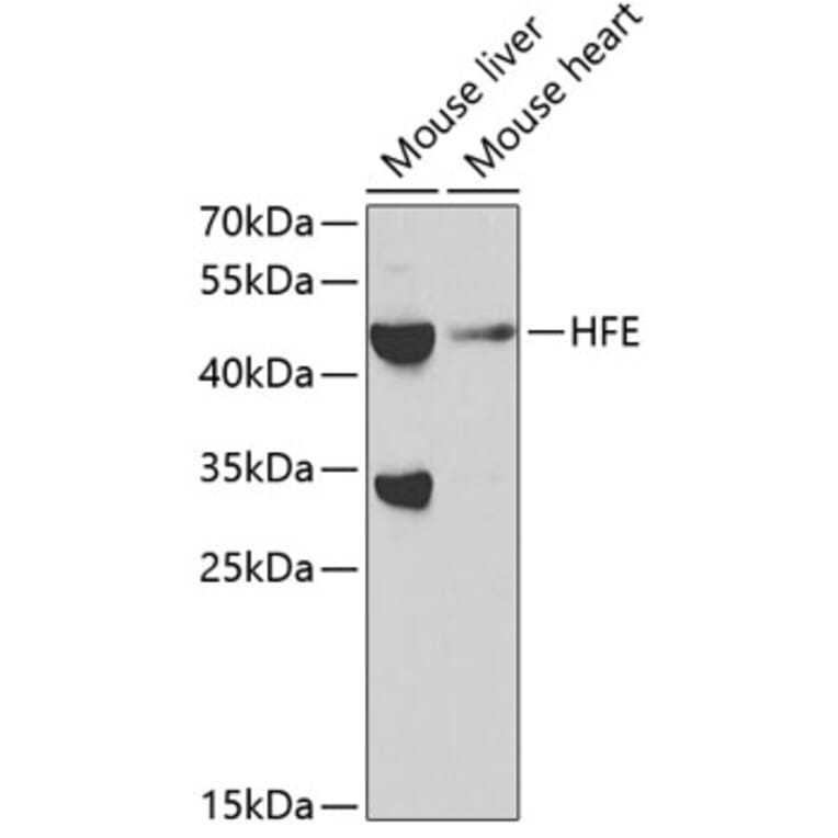 Western Blot - Anti-HFE Antibody (A11436) - Antibodies.com