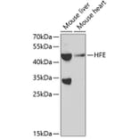 Western Blot - Anti-HFE Antibody (A11436) - Antibodies.com