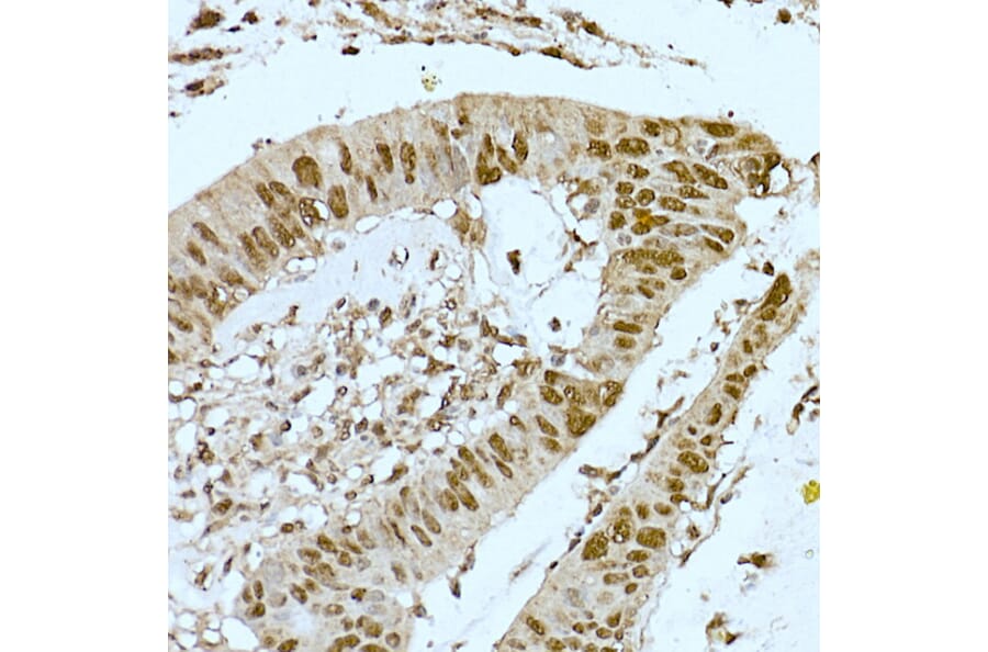 Immunohistochemistry - Anti-CREBBP Antibody (A11437) - Antibodies.com