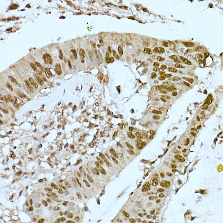 Immunohistochemistry - Anti-CREBBP Antibody (A11437) - Antibodies.com