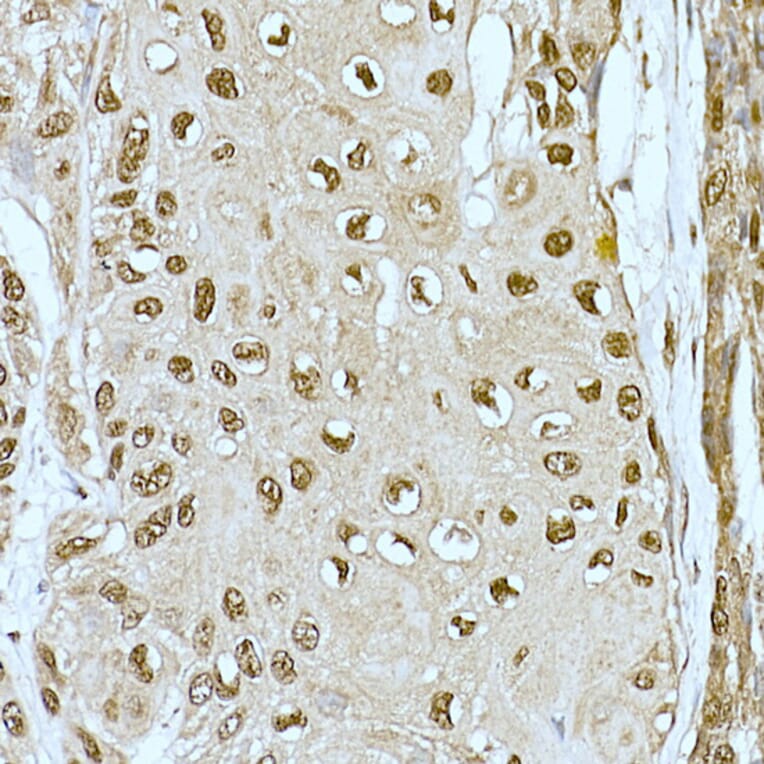 Immunohistochemistry - Anti-CREBBP Antibody (A11437) - Antibodies.com