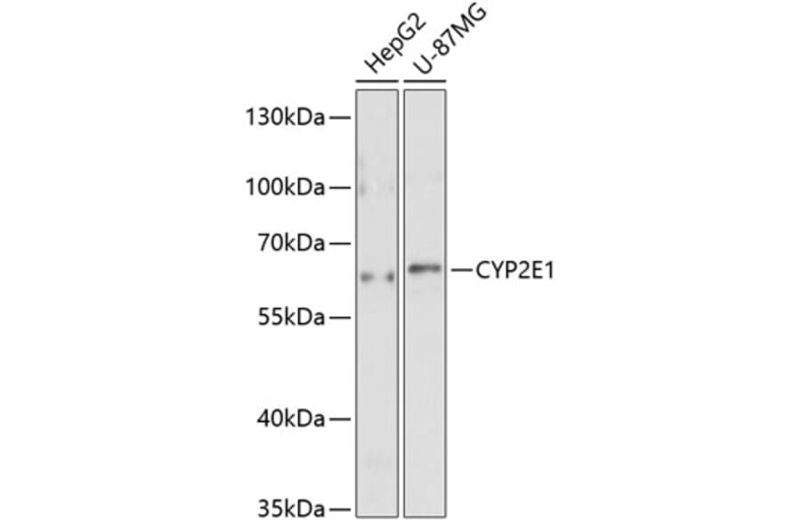 Western Blot - Anti-CYP2E1 Antibody (A1342) - Antibodies.com