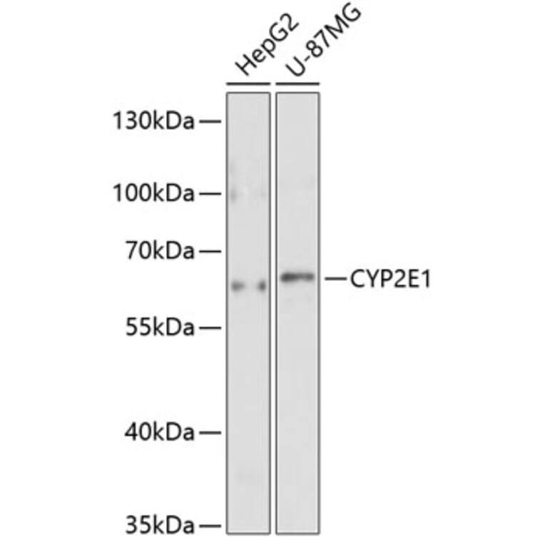 Western Blot - Anti-CYP2E1 Antibody (A1342) - Antibodies.com