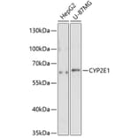 Western Blot - Anti-CYP2E1 Antibody (A1342) - Antibodies.com