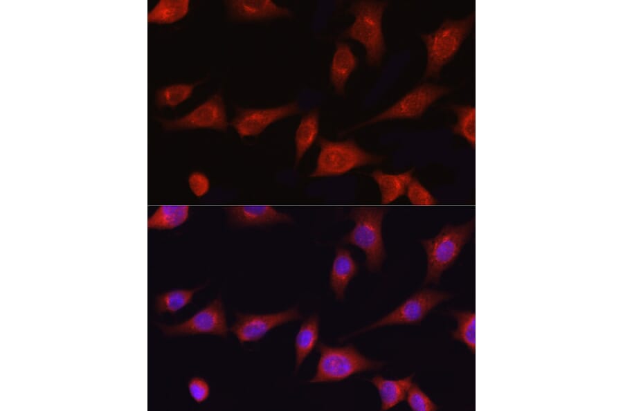 Immunofluorescence - Anti-Collagen I Antibody (A11439) - Antibodies.com