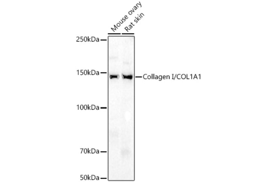 Western Blot - Anti-Collagen I Antibody (A11439) - Antibodies.com