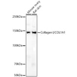 Western Blot - Anti-Collagen I Antibody (A11439) - Antibodies.com