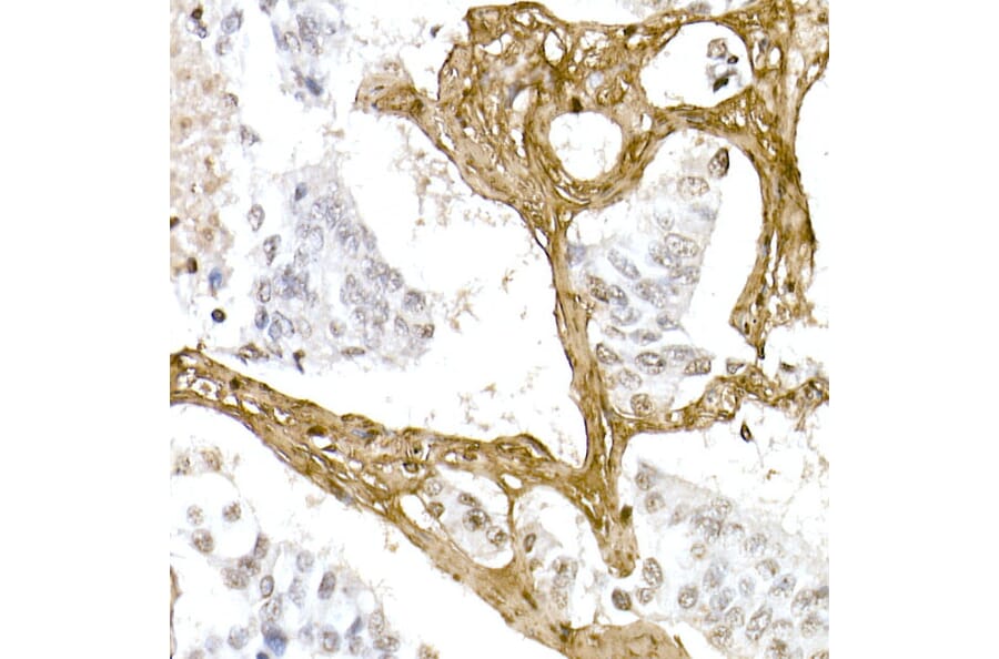 Immunohistochemistry - Anti-Collagen I Antibody (A11439) - Antibodies.com