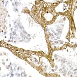 Immunohistochemistry - Anti-Collagen I Antibody (A11439) - Antibodies.com