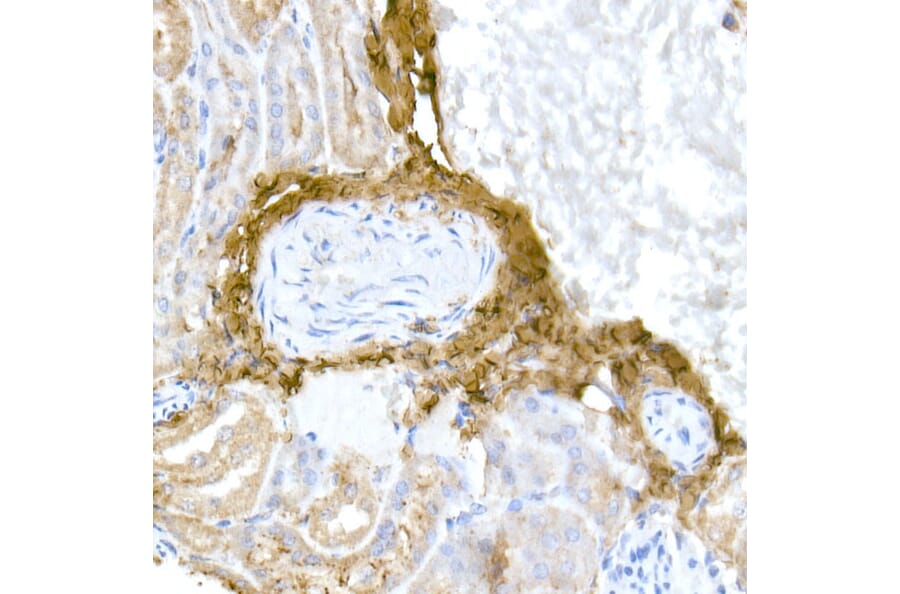 Immunohistochemistry - Anti-Collagen I Antibody (A11439) - Antibodies.com