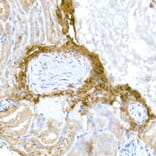 Immunohistochemistry - Anti-Collagen I Antibody (A11439) - Antibodies.com