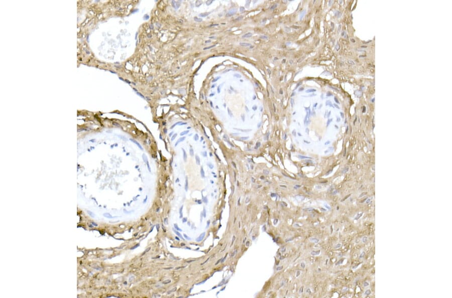 Immunohistochemistry - Anti-Collagen I Antibody (A11439) - Antibodies.com