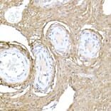 Immunohistochemistry - Anti-Collagen I Antibody (A11439) - Antibodies.com