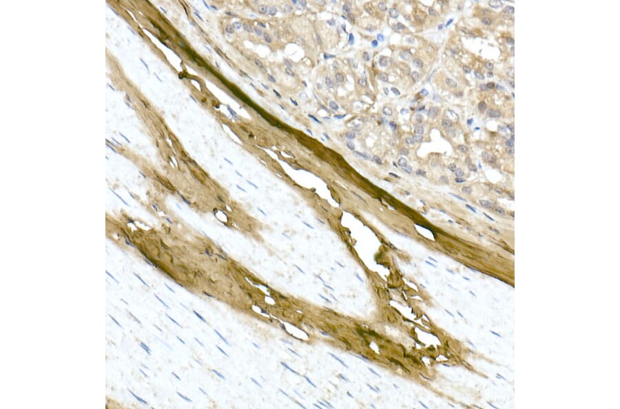 Immunohistochemistry - Anti-Collagen I Antibody (A11439) - Antibodies.com
