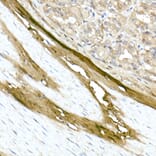 Immunohistochemistry - Anti-Collagen I Antibody (A11439) - Antibodies.com