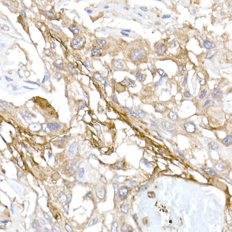 Immunohistochemistry - Anti-Collagen I Antibody (A11439) - Antibodies.com