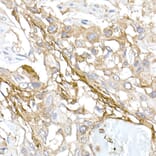 Immunohistochemistry - Anti-Collagen I Antibody (A11439) - Antibodies.com