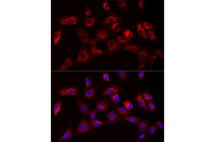 Immunofluorescence - Anti-Collagen I Antibody (A11439) - Antibodies.com